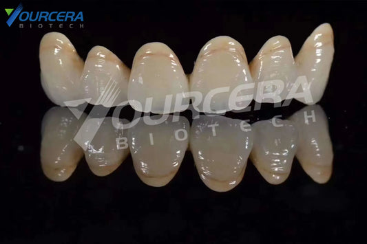 What is zirconia all ceramic tooth?  How are zirconia all ceramic teeth processed?