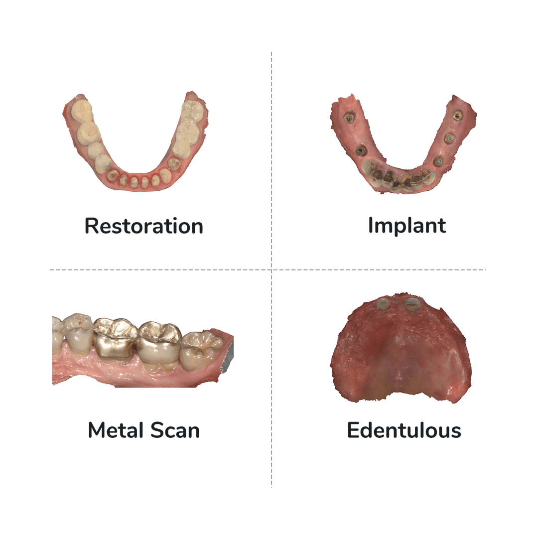 More Real Scanning Cases